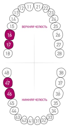 Кламп для коффердама Dentech (Япония) 203